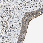 GRRP1 Antibody in Immunohistochemistry (Paraffin) (IHC (P))