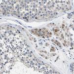 TOR1B Polyclonal Antibody