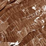 MACF1 Polyclonal Antibody