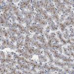 NHLRC3 Polyclonal Antibody