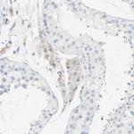FMO3 Antibody in Immunohistochemistry (Paraffin) (IHC (P))
