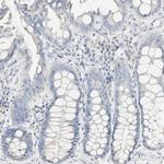 FMO3 Antibody in Immunohistochemistry (IHC)