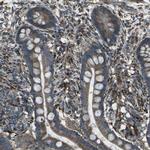 LSMEM1 Antibody in Immunohistochemistry (Paraffin) (IHC (P))