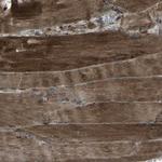 LSMEM1 Antibody in Immunohistochemistry (Paraffin) (IHC (P))