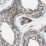 LSMEM1 Polyclonal Antibody