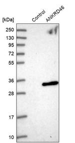 ANKRD46 Antibody in Western Blot (WB)