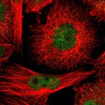 CMTM1 Polyclonal Antibody