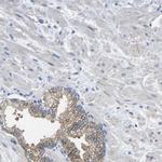 CMTM1 Antibody in Immunohistochemistry (Paraffin) (IHC (P))