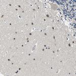 PCNXL2 Polyclonal Antibody