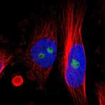 KIAA1551 Polyclonal Antibody