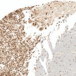 KIAA1551 Antibody in Immunohistochemistry (Paraffin) (IHC (P))