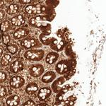 KIAA1551 Antibody in Immunohistochemistry (Paraffin) (IHC (P))