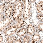 KIAA1551 Antibody in Immunohistochemistry (Paraffin) (IHC (P))