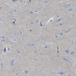 CRB3 Antibody in Immunohistochemistry (Paraffin) (IHC (P))