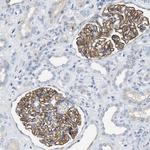 CRB3 Antibody in Immunohistochemistry (Paraffin) (IHC (P))