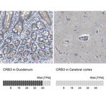 CRB3 Antibody in Immunohistochemistry (IHC)