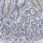 CRB3 Antibody in Immunohistochemistry (IHC)