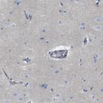 CRB3 Antibody in Immunohistochemistry (IHC)