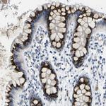 FAM3D Polyclonal Antibody