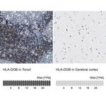 HLA-DOB Polyclonal Antibody