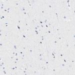 HLA-DOB Antibody in Immunohistochemistry (IHC)
