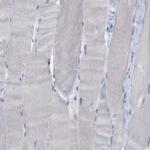 ALOX15 Antibody in Immunohistochemistry (Paraffin) (IHC (P))
