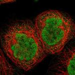 TIAM2 Polyclonal Antibody