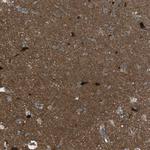 TIAM2 Antibody in Immunohistochemistry (IHC)