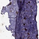 MGP Polyclonal Antibody