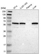 KLHL5 Antibody in Western Blot (WB)