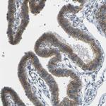 RHBDD1 Antibody in Immunohistochemistry (Paraffin) (IHC (P))