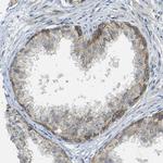 RHBDD1 Antibody in Immunohistochemistry (Paraffin) (IHC (P))