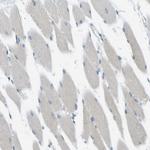 RHBDD1 Antibody in Immunohistochemistry (Paraffin) (IHC (P))
