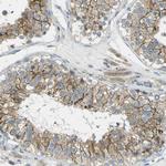 RHBDD1 Polyclonal Antibody