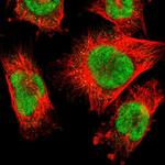 RBM7 Polyclonal Antibody