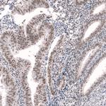 RBM7 Antibody in Immunohistochemistry (IHC)