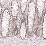 RBM7 Antibody in Immunohistochemistry (IHC)