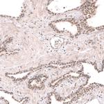 RBM7 Antibody in Immunohistochemistry (IHC)