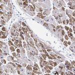 NEBL Polyclonal Antibody