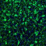 NECAB2 Antibody in Immunohistochemistry (Paraffin) (IHC (P))