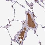 IGFL1 Polyclonal Antibody