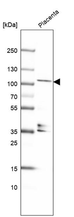 KANK4 Antibody in Western Blot (WB)