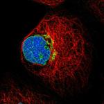 FUT11 Polyclonal Antibody