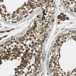 FUT11 Antibody in Immunohistochemistry (Paraffin) (IHC (P))