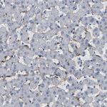 CLEC4G Antibody in Immunohistochemistry (Paraffin) (IHC (P))
