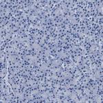 CLEC4G Polyclonal Antibody