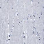 CLEC4G Antibody in Immunohistochemistry (Paraffin) (IHC (P))