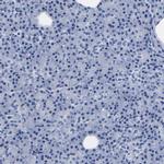 CLEC4G Antibody in Immunohistochemistry (IHC)