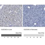 CLEC4G Antibody