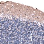 LRRC55 Antibody in Immunohistochemistry (Paraffin) (IHC (P))